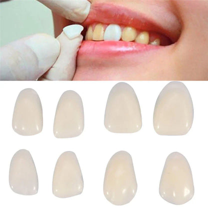 Dental Temporary Porcelain Crown Veneer for Anterior Front Teeth Whitening