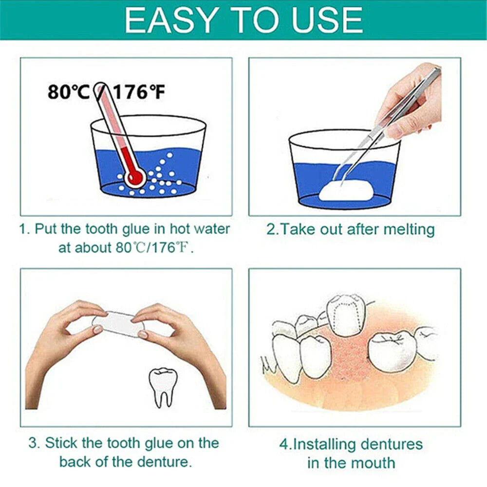 Dental Temporary Porcelain Crown Veneer for Anterior Front Teeth Whitening