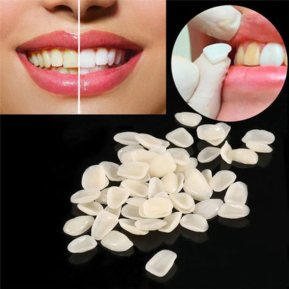 Dental Temporary Porcelain Crown Veneer for Anterior Front Teeth Whitening